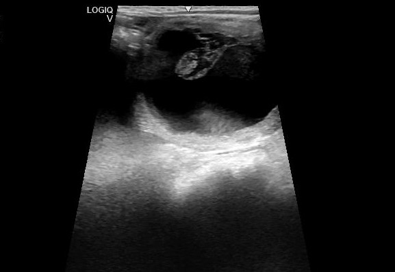 Pregnant mare ultrasound